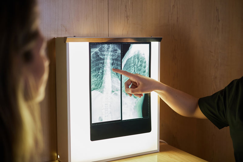 doctor with patient looking at an xray of the spine